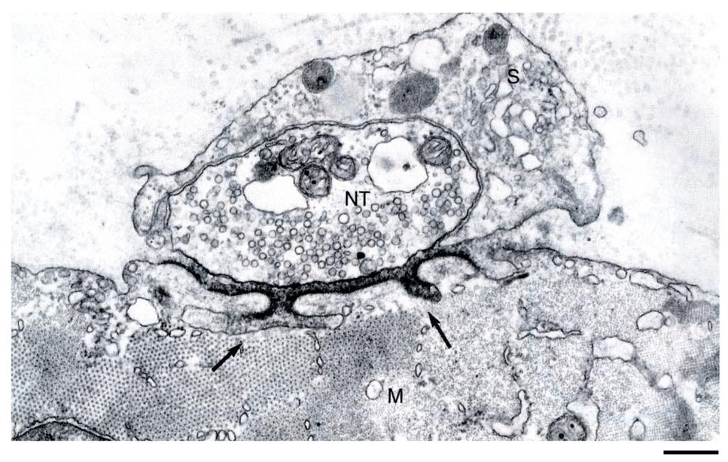 Pre and postsynaptic membranes at the NMJ are highly specialized Electron micrograph of a NMJ shows the nerve terminal capped by a Schwann cell situated in a