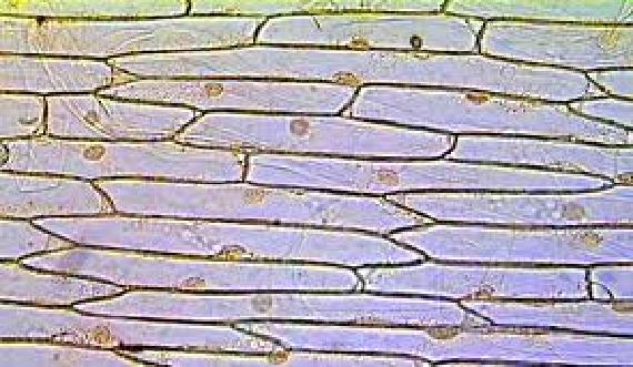 Onion leaf skin stained with dye makes the cell Boundaries and nuclei clearly visible. Another problem with light microscopy is that most living cell are nearly transparent.