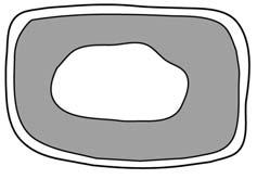Fig 3 shows the appearance of a plant cell when immersed in three different concentrations of sugar. Fig 3 cell wall A B C cytoplasm vacuole The cell has absorbed water from the solution.