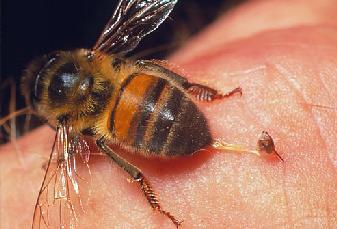 buangkan sengat lebah secepat mungkin Rub the toothpaste on the bee sting site