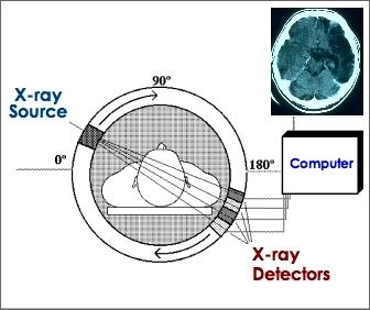 Computerized Axial Tomography CAT- Scan