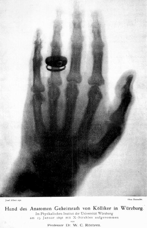 X-ray (image) the