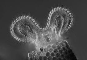 Cilia Parmecium, a uni-cellular protist, with
