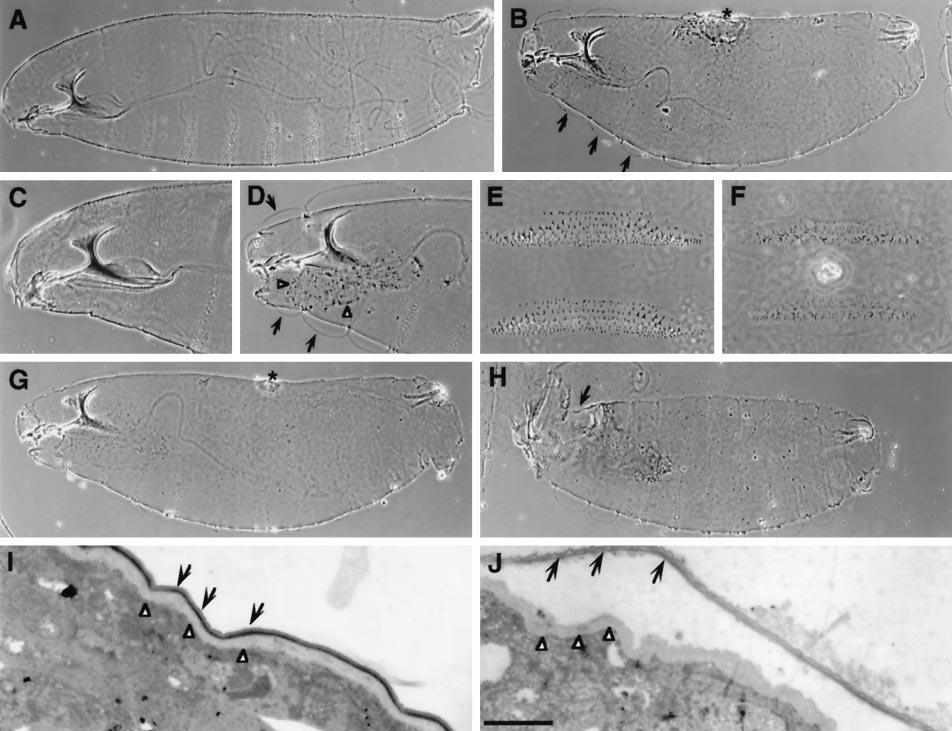 Phenotypic Analysis of coracle Figure 1. Cuticular phenotypes of coracle mutant embryos. Phase-contrast photomicrographs of wild-type (A, C, and E) and coracle mutant embryos (B, D, and F).