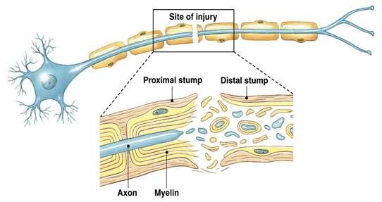 Integration: Injury to Neurons If the cell body is not damaged the neuron will most