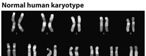 What is the result of mitosis? # of cells? Ploidy? Similar/dissimilar? Dance of the chromosomes http://www.