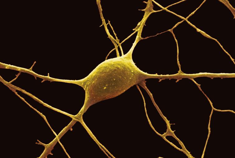 Neurons Cell size is limited. Section 5.