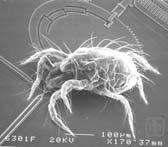 1-2 mm Ant ~ 5 mm 10-3 m