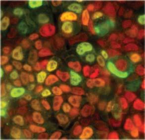 c, Mouse embryonic stem cells show relatively homogeneous expression of Oct4 (red nuclear protein staining), but heterogeneous expression of Nanog (green nuclear protein staining).