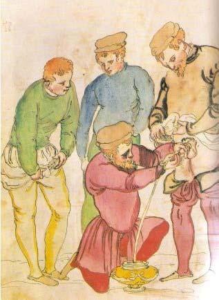 Hippocrates the Father of Urology Italian medical picture book ±1510 I will not cut for stone even for patients in