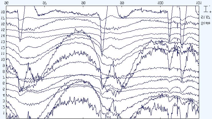 An Example of EEG Theory