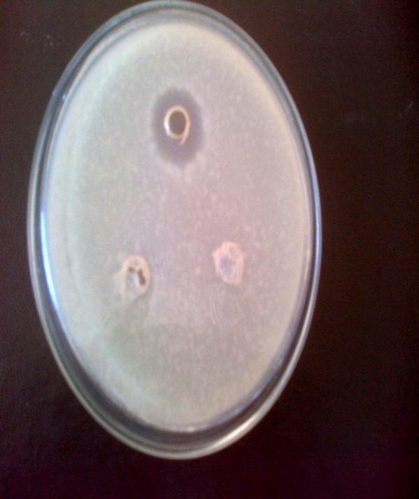 (A). S. mutans (B) B. subtilis (C) E.coli (D) P.