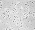 Mycobacteria Lack a rigid cell wall Bacterial Arrangements Pairs Neisseria