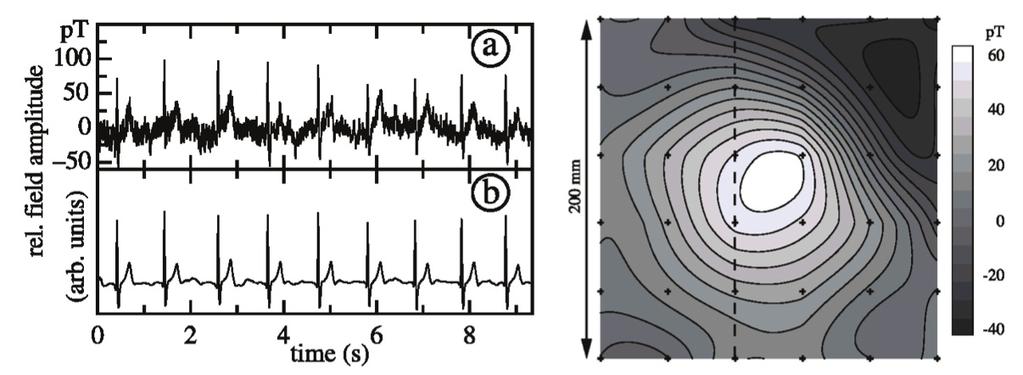 Other AM MCG results Shot-noise limited M x non-serf magnetometer Bison et al.