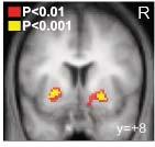 , J Neurosci, 2 Anatomical Background for DCM 26 Prediction error (PE) activity in the putamen PE