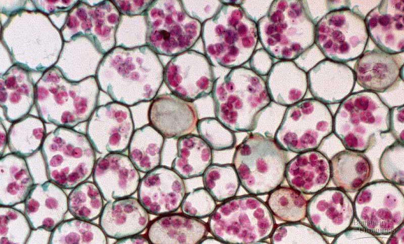 Parenchyma Tissue Made up of Parenchyma Cells Living