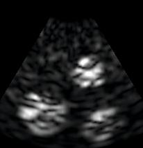 Simulation of Harmonic Ultrasound Images 369 5 Scattering Phantom B-Mode Image Harmonic Image z position [mm] 15 25 35 45 20 10 0 10 20 20 10 0 10 20 20 10 0 10 20 Fig. 3. Simulated B-mode ultrasound images of a scattering phantom.