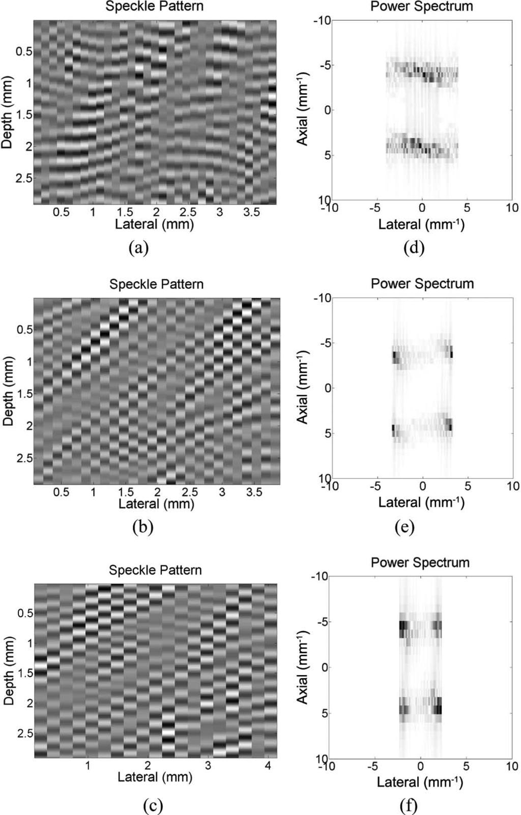 The power spectrum of the speckle pattern: scan velocity is (d) 20 cm/s, (e) 50 cm/s, and (f) 80 cm/s. Simulated plug blood flow with A-line increment equal to onefourth of the lateral beam width.