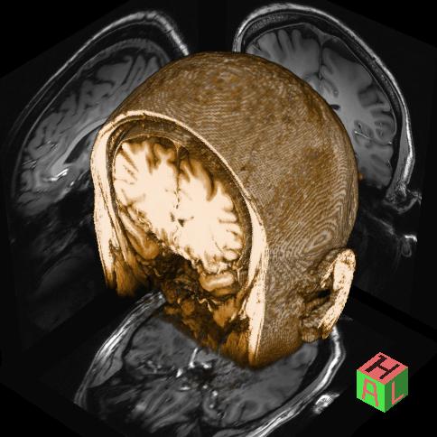 3D Neuro MRI