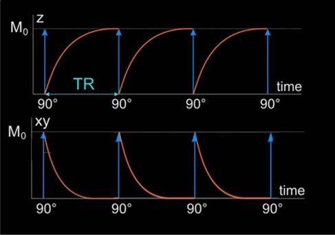 Signal of the Gradient Echo Sequence Case I: = 90, TR >> T1 (full recovery) M z M 0 M xy M E M xy M z * 2 0 (saturation recovery) S PD E * 2 Convention: The