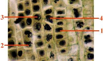 Here is a photomicrograph showing the cells