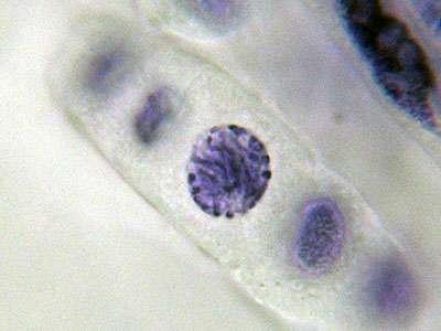 Prophase: the chromosomes begin to condense,