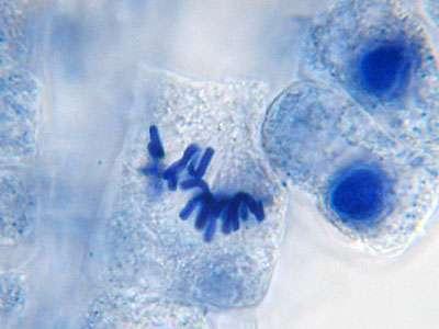 Metaphase: the chromosomes line up