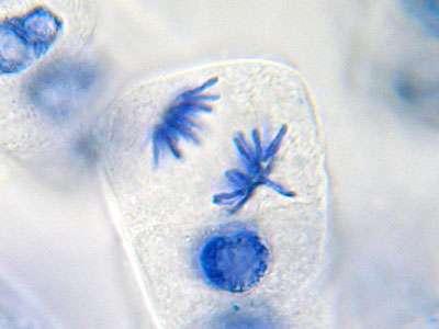 Anaphase: the chromosome pairs divide and the