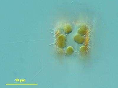 protozoans; 50 µm to