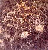 Mycorrhizae (root fungus) - extension of root system - fungus enhances nutrient and water intake -