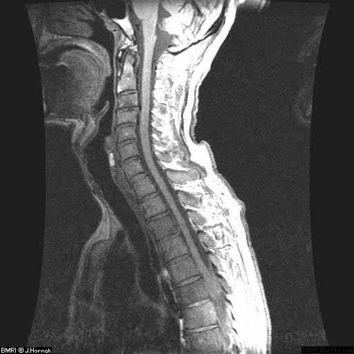 APPLICATIONS: Medical MRI (Magnetic Resonance