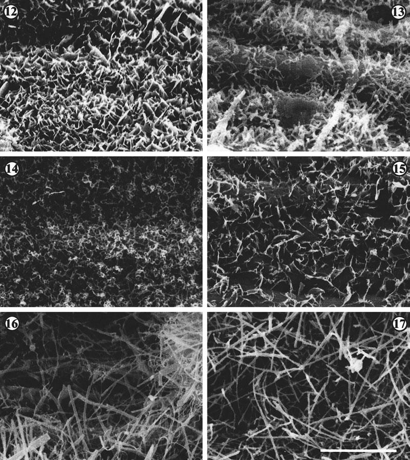 FESTUCA INOPS AND F. GRACILIOR 251 Figures 12 17. Different types of epicuticular waxes that could be found in F. inops and F. gracilior. Fig. 12. Platelets (France, Vaucluse). Fig. 13: tubules (Italy, Castelluccio).