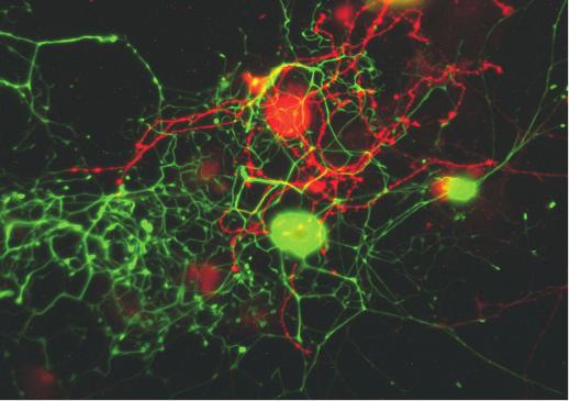 Mechanoreceptors make up most myelinated afferents and stained positive for heavy neurofilament NF200 (green). Nociceptors often express the capsaicin receptor TRPV1 (red).