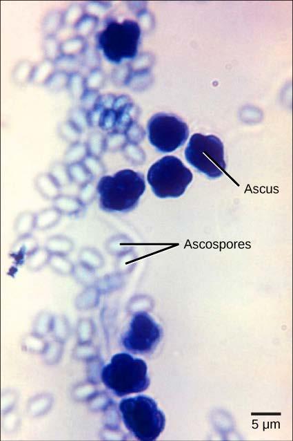 Ascomycota (sac fungi) form an ascus (sac), includes yeasts and some disease causing fungi (fungal pneumonia) conidia are the asexual reproductive structures, and asci are the sexual reproductive