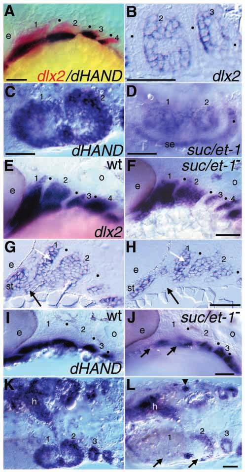 sucker encodes a zebrafish Endothelin-1 3821 Fig. 5. dlx2, dhand, and suc/et-1 expression in wild-type (A-E,G,I,K) and suc/et-1 mutants (F,H,J,L).