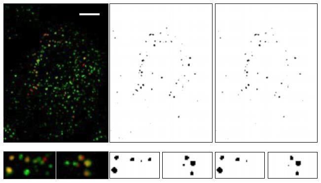 Spatial Colocalization by Image Analysis For two molecules to interact, they must be located in the same