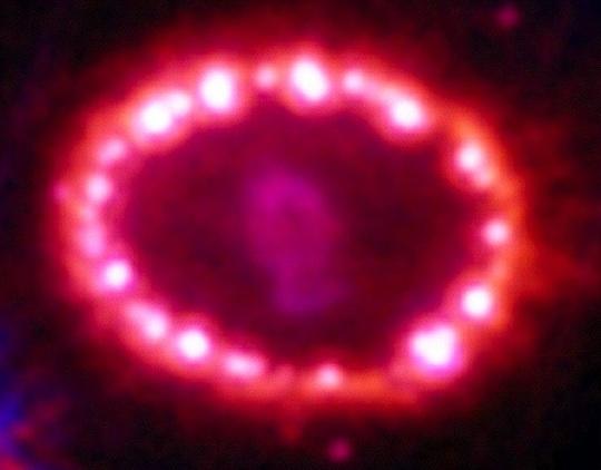 Direct Imaging SN 1987A Suggests a