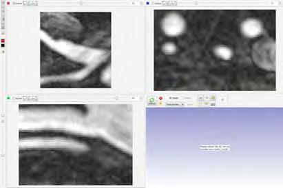 related image sets, and software packages for segmenting out the anatomic regions of interest.