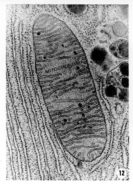 - mitochondria are partly autonomous (semiautonomous) structures: they contain DNA and their own ribosomes and produce own proteins - they are able divide themselves (replication) Ribosomes - small