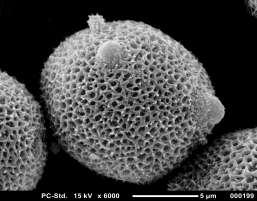 III. Methods Pollen Characters (15) Quantitative (5) Qualitative (10) Lumen size Pollen