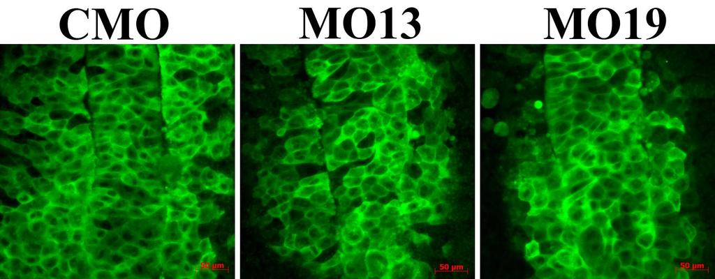 Figure 4.13: GFP-Dishevelled Localization in the Dorsal Mesoderm. Open face explants from embryos injected with CMO, MO13 or MO19 at the one-cell stage.