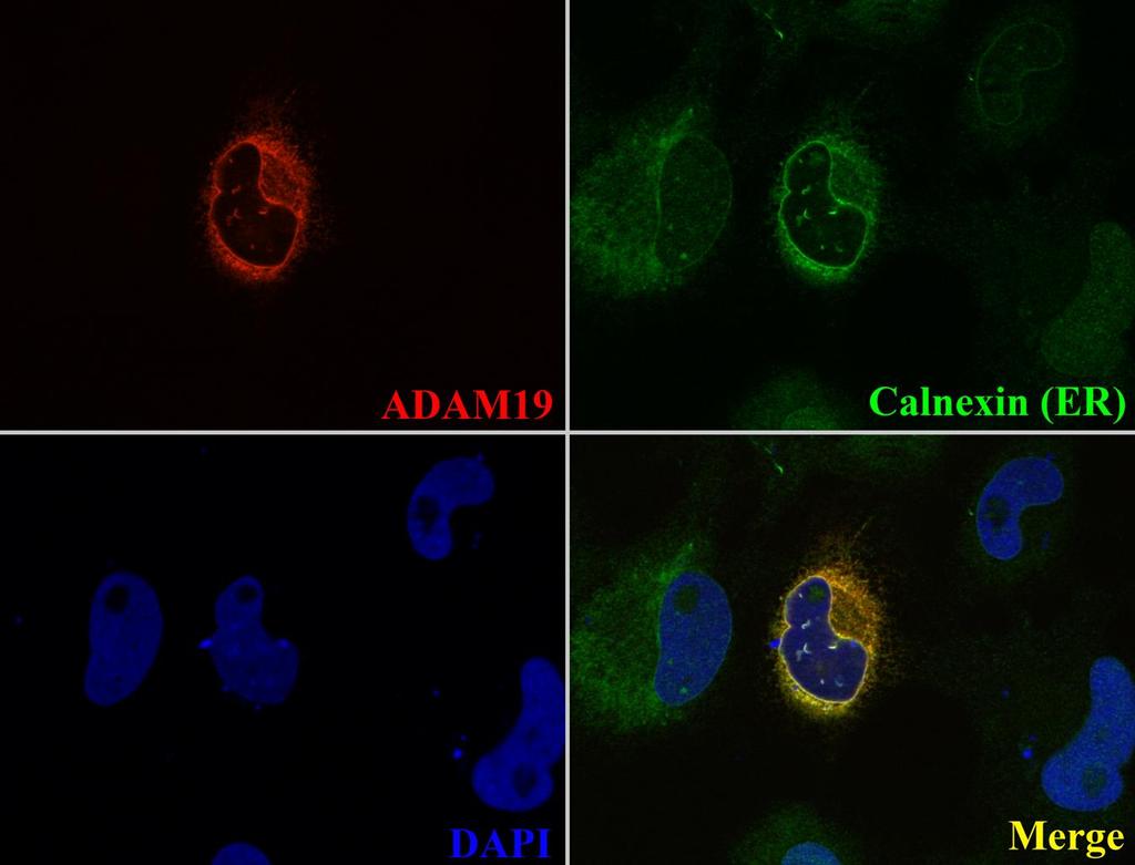 Figure 3.6: ADAM19 Localizes to the Endoplasmic Reticulum in XTC Cells.