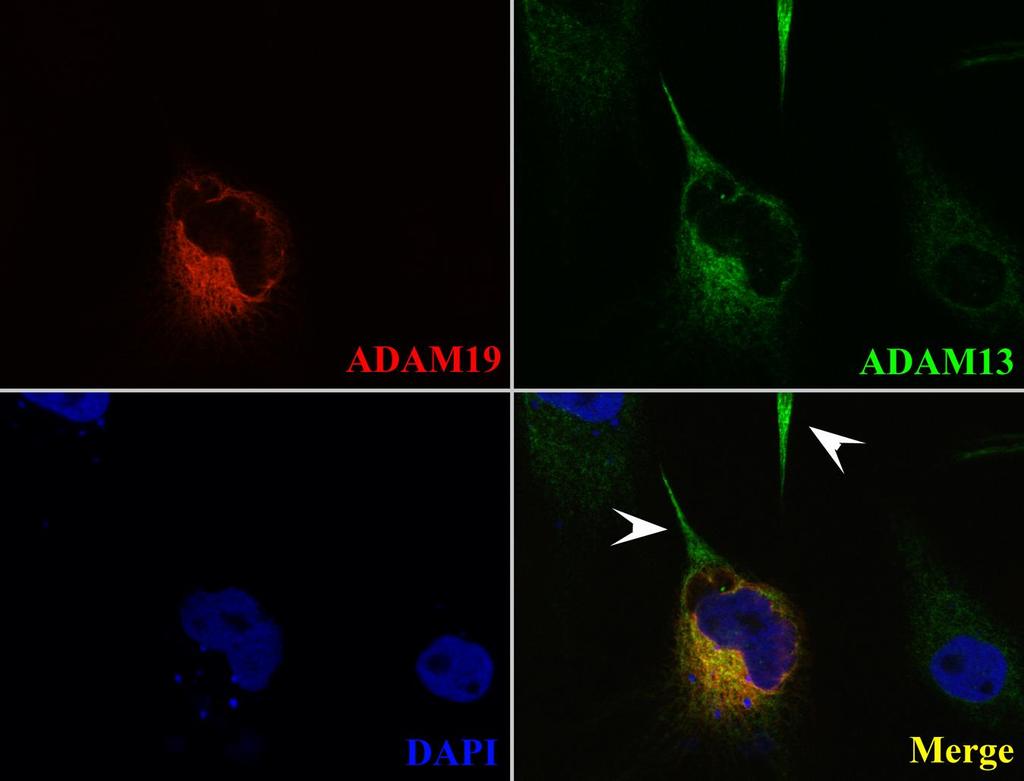 Figure 3.7: ADAM13 and ADAM19 Colocalize to a Perinuclear Compartment in XTC Cells.