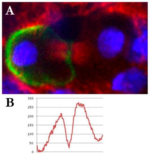 Figure 5. Asymmetric quantities of acetylated tubulin on the central spindle. A: Staining of acetylated tubulin in an SOP cell in cytokinesis.