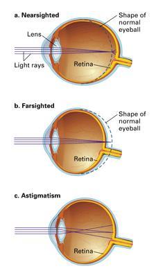 Sight: the changing f light t chem-electrical impulses t be interpreted by the brain. Figure 6 Structure f the Eye Light passes thrugh the crnea past the pupil t be fcused n the retina by the lens.