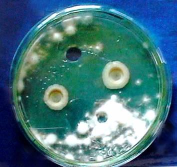 According to the results obtained by studies, the 6 strains, characterized by a high antagonistic activity to test cultures of pathogenic fungi: 21(8), 22T, 82, 177,
