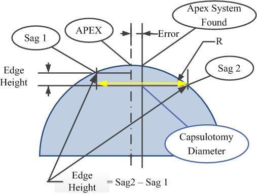 Figure 69 Edge Height results from positional error in apex location. Table 10 Axial treatment length versus lateral radial error in position Capsulotomy Parameter Diameter 5.