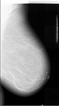 Screening Mammography) (Laine, 1993; Li et al.