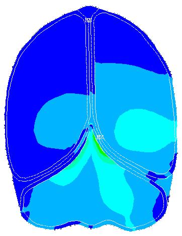 The finite element code may be used in this regard because it may be modeled the contact between the brain and skull.
