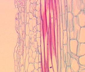 Simple Tissues : Sclerenchyma Fibers are sometimes found in association